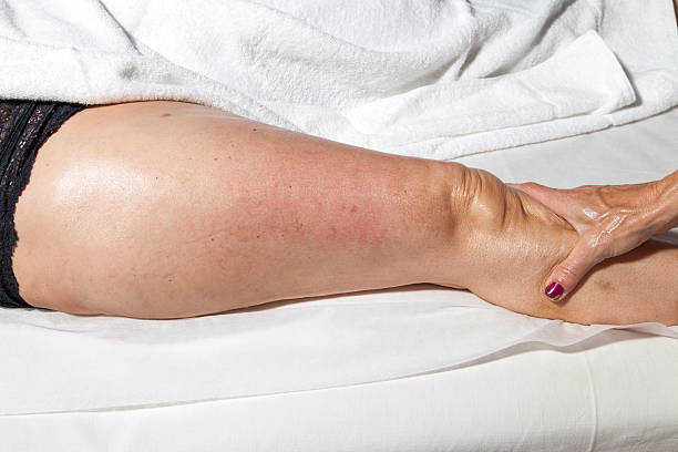 Frequent long-haul travel leg swelling